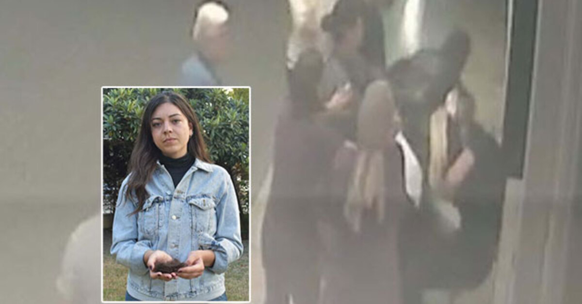 Dehşetin görüntüsü çıktı! Doktorun elinde bir tutam saçı kaldı!