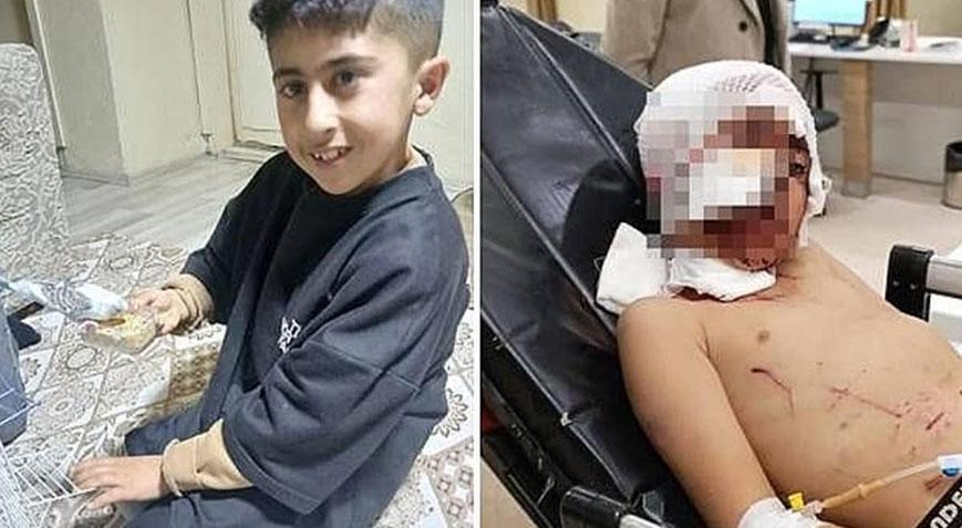 Bakkala giden çocuk dehşeti yaşadı! ‘Boğazında diş izleri vardı, kulak memesi ise yoktu’